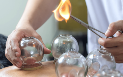 fire-cupping-12-8e5c50b6